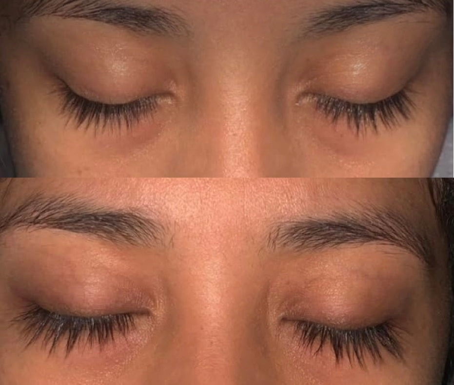 Unveiling the Truth: The Hidden Risks of Hormones in Eyelash Growth Serums